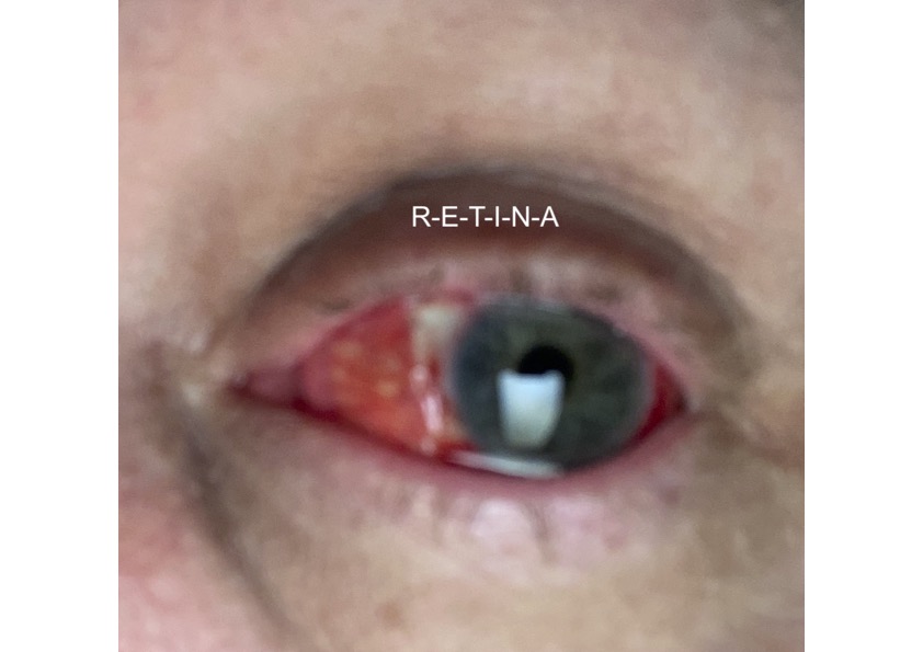 Retina.jpg