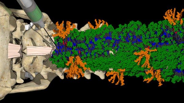 Injectable Therapy Forms Nanofibers