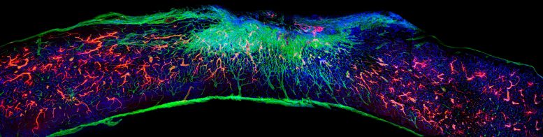 Longitudinal Spinal Cord Section